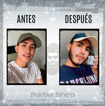 Tónico BARBA SHOP (Diferentes Combos Disponibles)