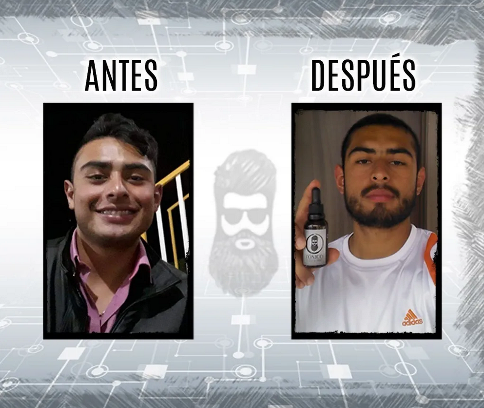 Tónico BARBA SHOP (Diferentes Combos Disponibles)