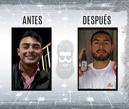 Tónico BARBA SHOP (Diferentes Combos Disponibles)