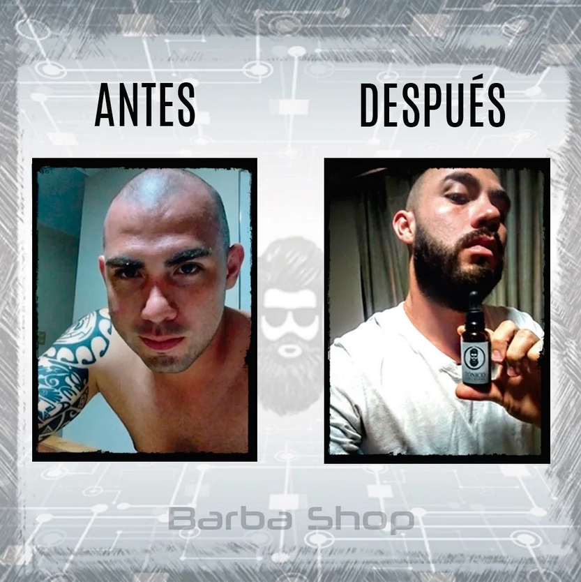 Tónico BARBA SHOP (Diferentes Combos Disponibles)